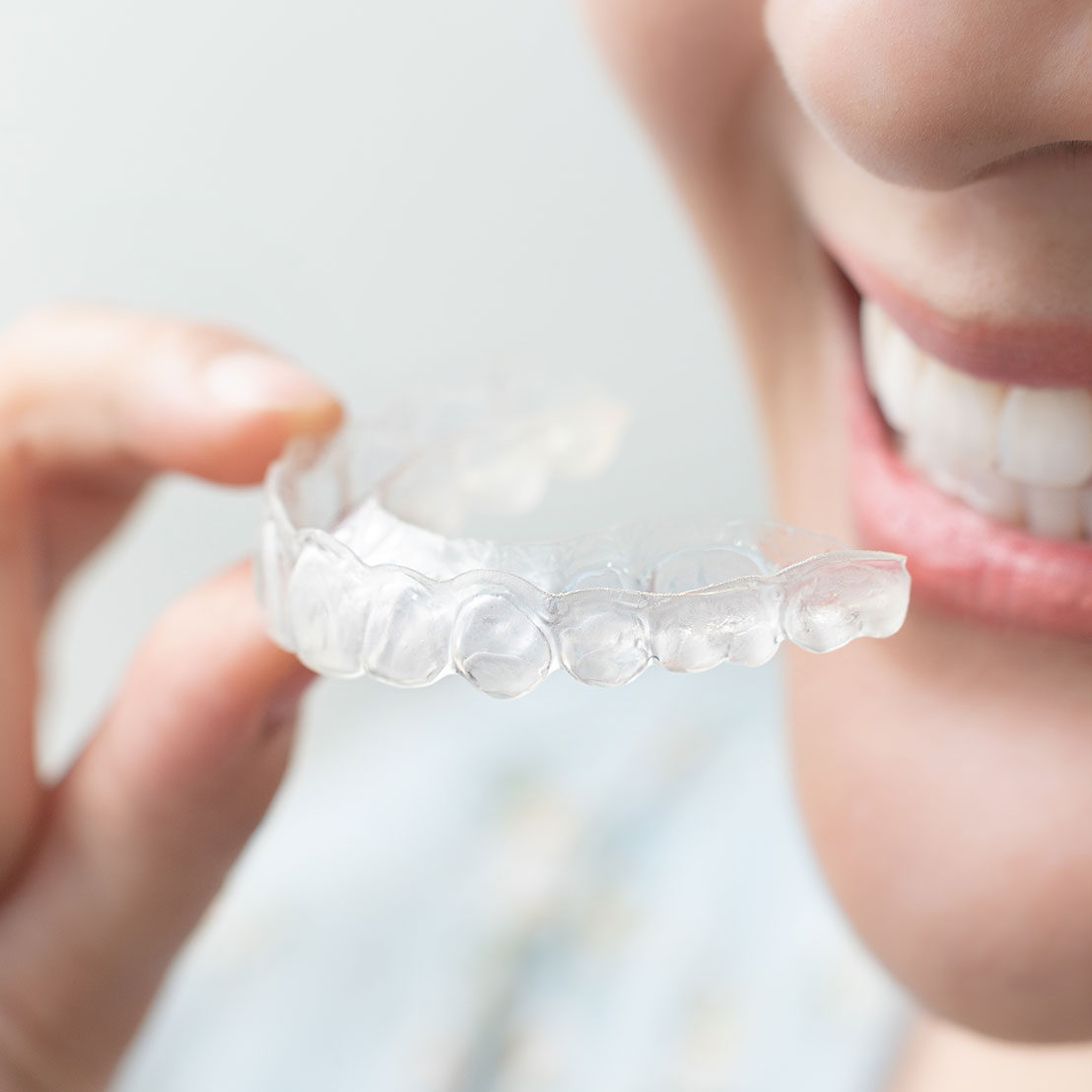 woman holding clear invisalign aligers in her hand